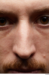 HD Face Skin John Hopkins face nose skin pores skin…